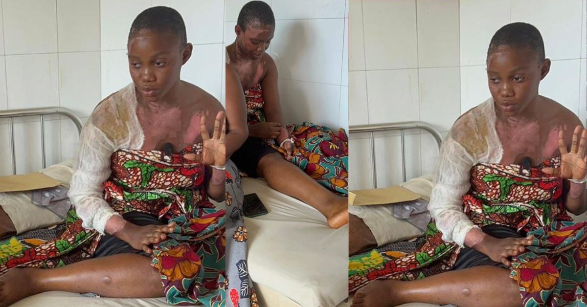 WASSCE Candidate Hospitalized After Alleged Hot Water Attack by Friend Over Relationship Dispute