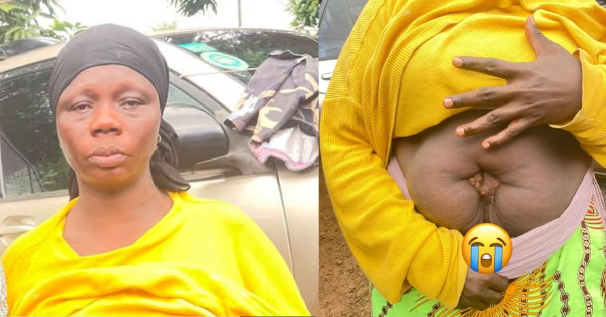 Woman Says Doctors Left Surgical Equipment in Her Body at Magburaka Hospital