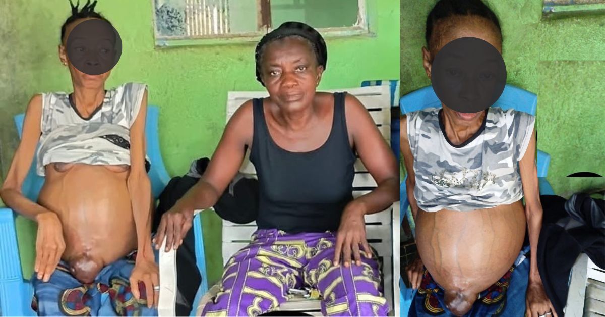 Family Appeals for Urgent Support as Young Woman Battles Critical Illness in Bo