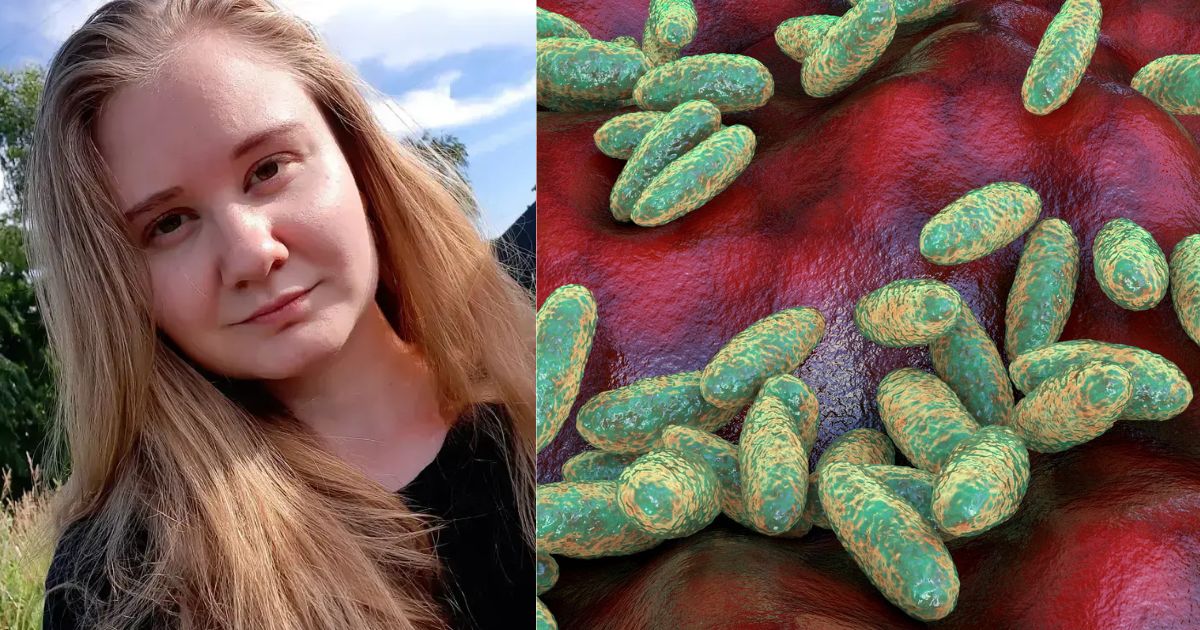 Pneumonic Plague: Suspected Deadly Disease Leaves One Dead in Russia, Over 200 Quarantined